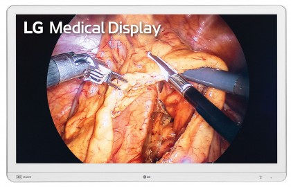 hirurgicheskij-monitor-lg-32hr734s.jpg (357.73 КБ) Просмотров: 1785 hirurgicheskij-monitor-lg-32hr734s.jpg